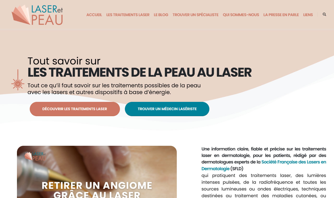 Laser et peau